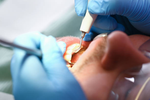 Best Emergency Cosmetic Dentistry (e.g., broken veneers) in Katy, TX