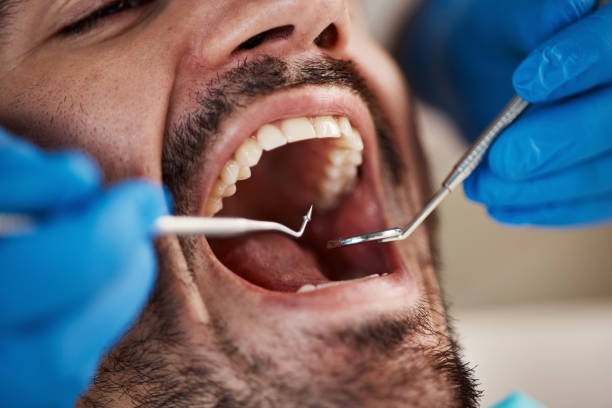 Best Emergency Denture Repair in Katy, TX