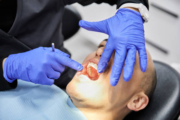 Best Broken or Chipped Tooth Repair in Katy, TX